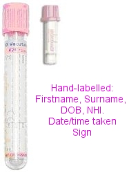 Pink top tubes for blood banking